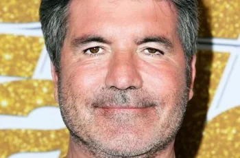 ‘AGT’ Star Simon Cowell Removed His Facial Fillers After Not Recognizing Himself – Before & After Photos